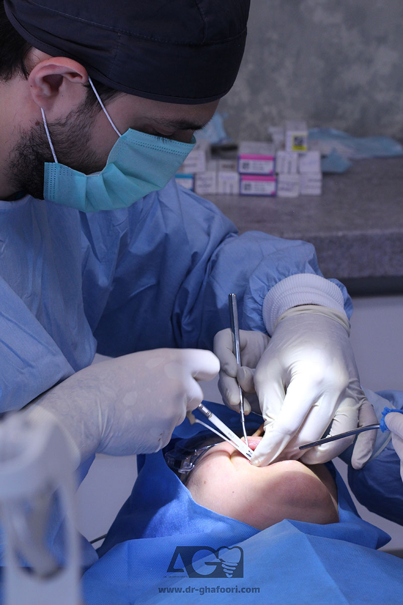 درباره جراحی لثه | دکتر آرش غفوری