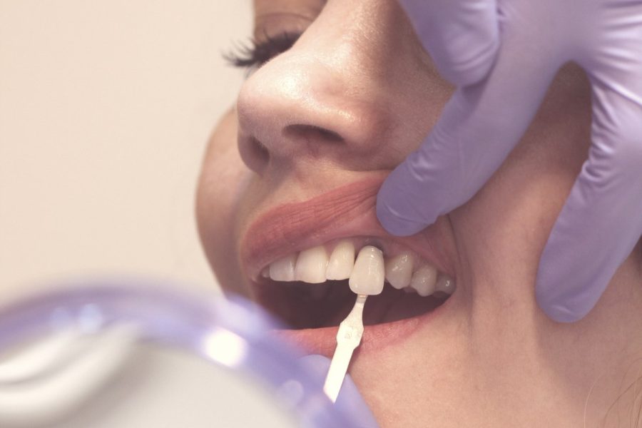 dental prosthesis