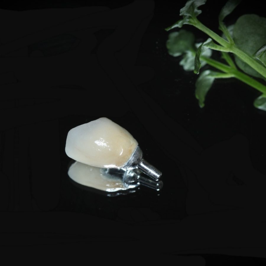 پروتز دندان