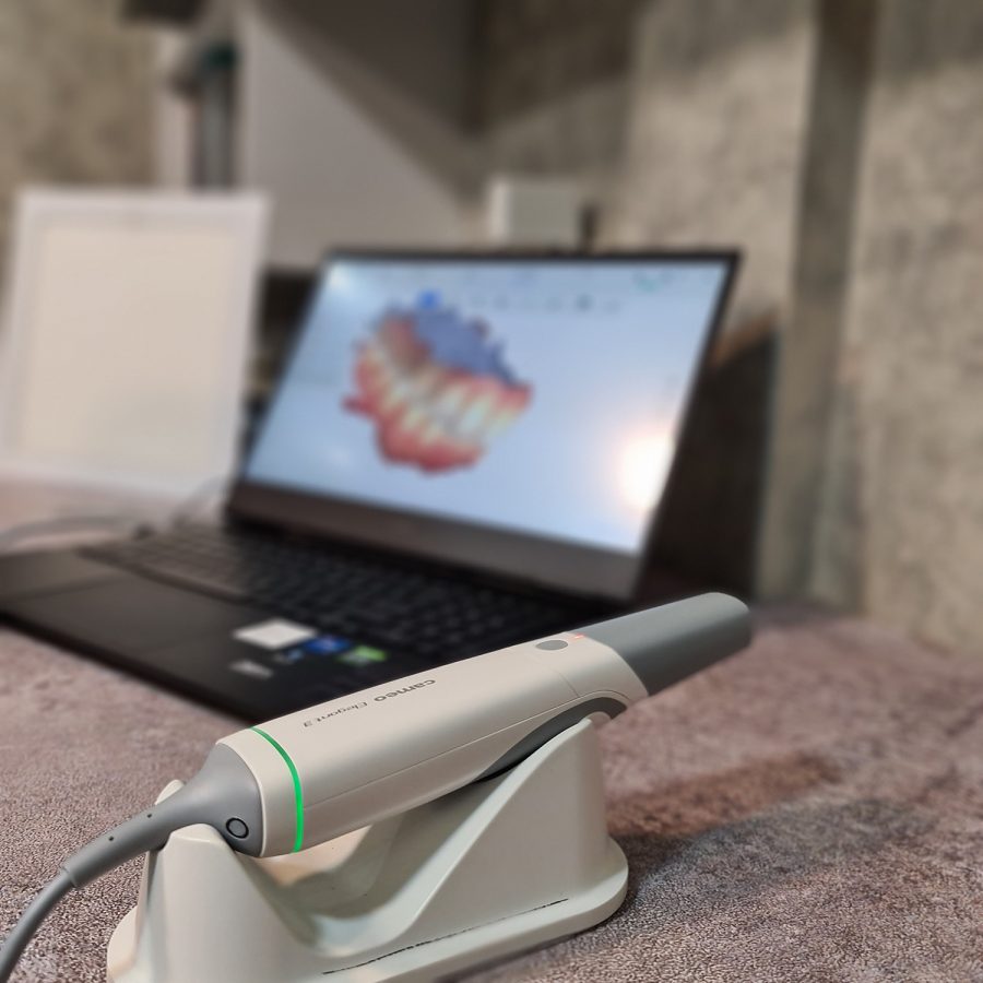 ایمپلنت دیجیتال