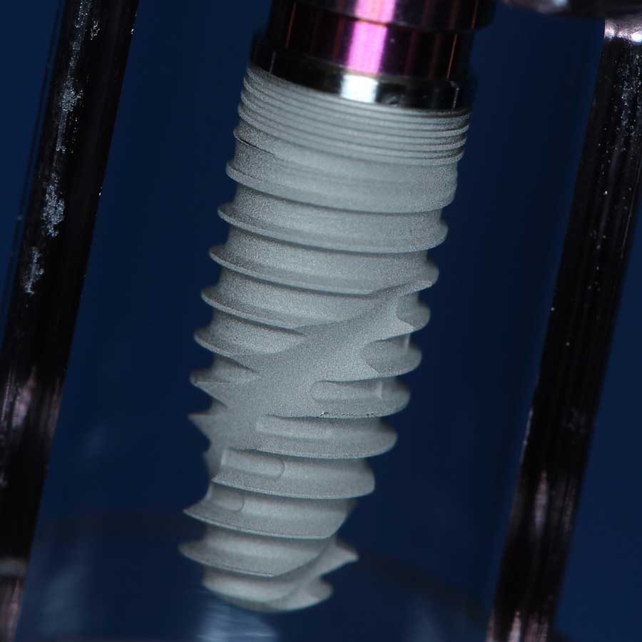 بهترین متخصص ایمپلنت در رشت